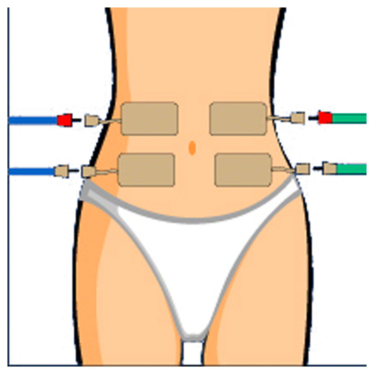 Compex Fils d'électrodes