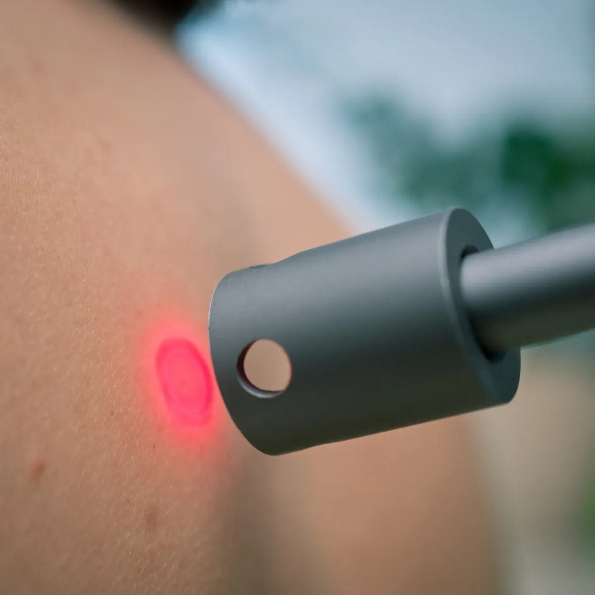 qmd® helios cryo-thermal - combinato Sistema