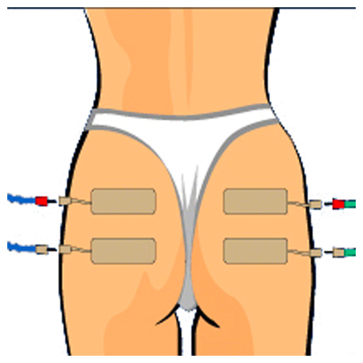 Compex Fils d'électrodes
