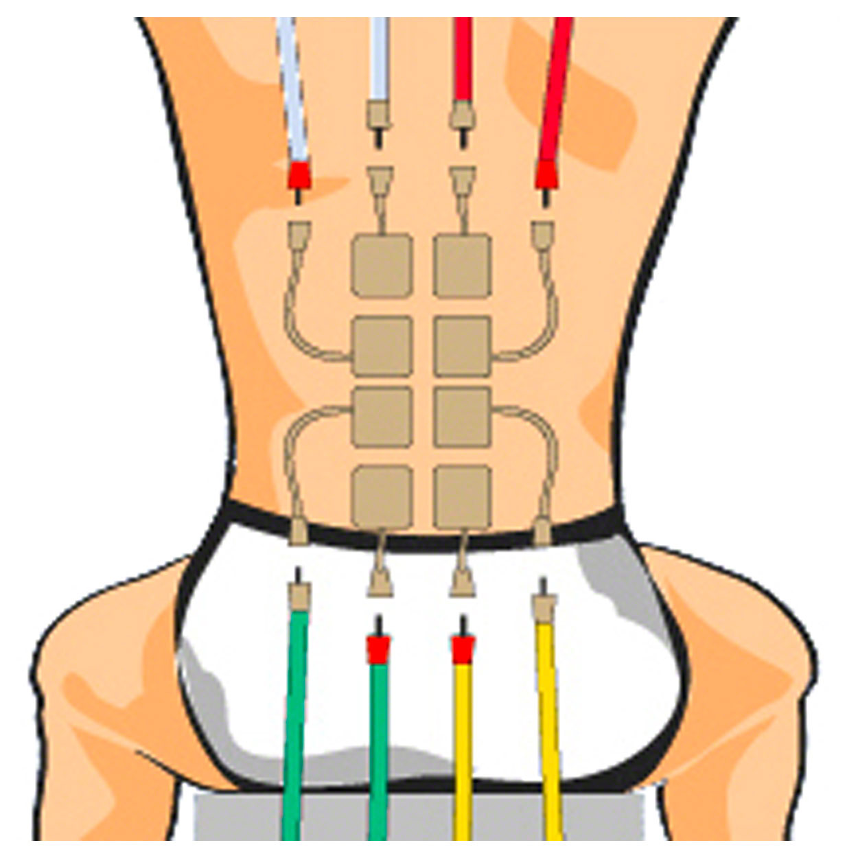Compex Fils d'électrodes