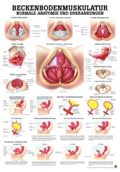 «Beckenbodenmuskulatur», laminiert 