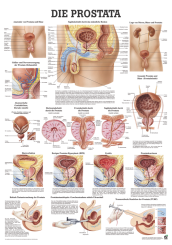 «Die Prostata», laminiert 