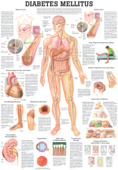 «Diabetes Mellitus», laminiert 