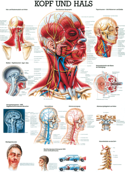 «Kopf und Hals», laminiert 