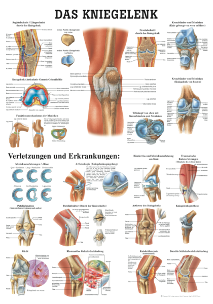 «Das Kniegelenk», laminiert 