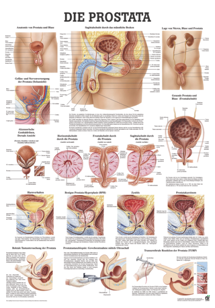 «Die Prostata», laminiert 