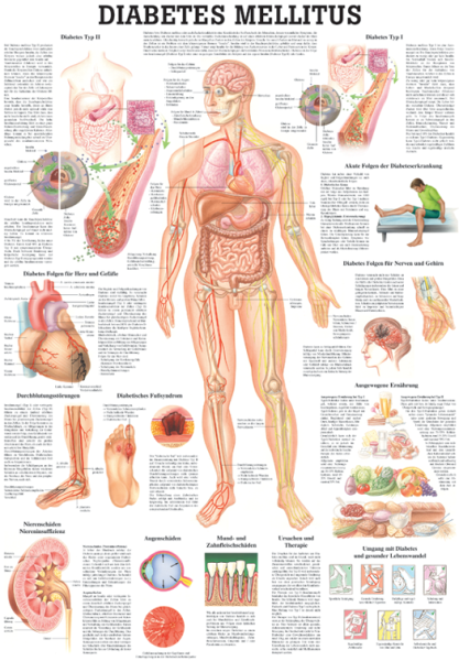 «Diabetes Mellitus», laminiert 